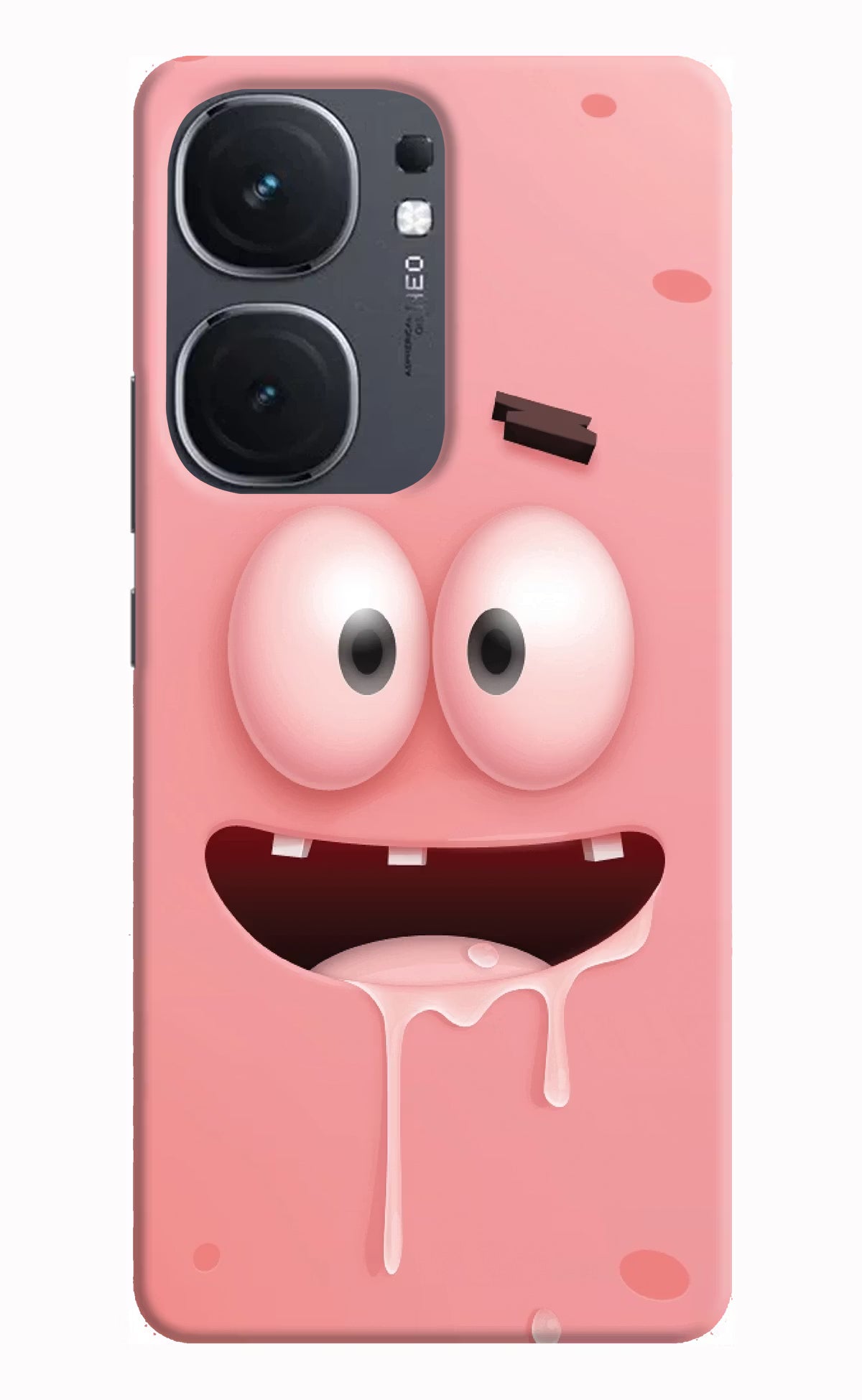 Sponge 2 IQOO Neo9 Pro Hard Case Back Cover by Casekaro