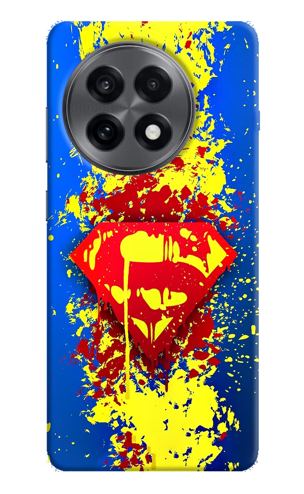 Superman logo OnePlus 13R Hard Case Back Cover by Casekaro