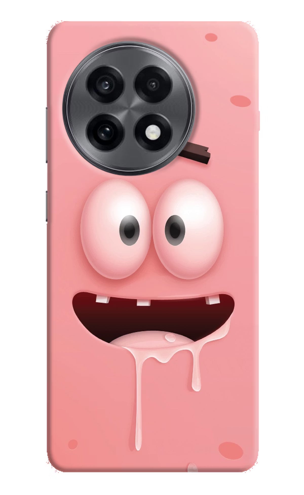 Sponge 2 OnePlus 13R Hard Case Back Cover by Casekaro