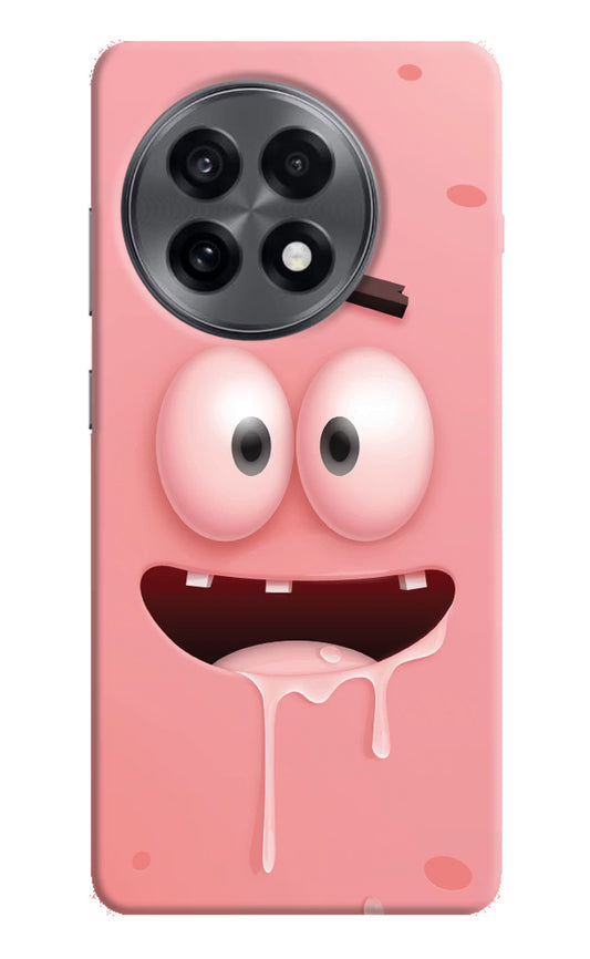 Sponge 2 OnePlus 13R Hard Case Back Cover by Casekaro