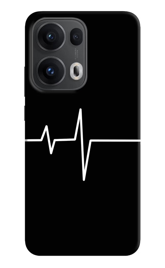 Heart Beats Oppo Reno13 Pro 5G Hard Case Back Cover by Casekaro