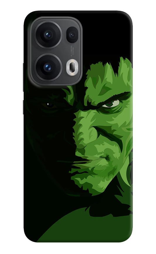 HULK Oppo Reno13 Pro 5G Hard Case Back Cover by Casekaro
