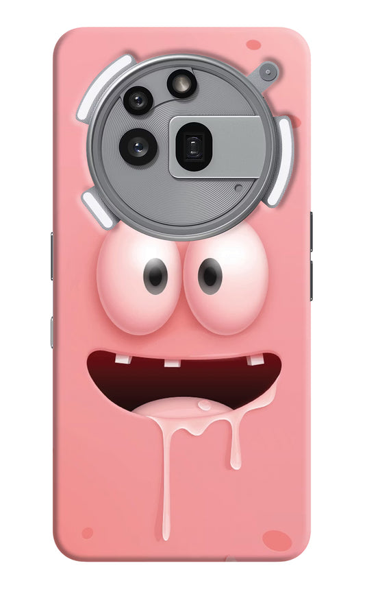 Sponge 2 Nothing Phone 3a Pro Hard Case Back Cover by Casekaro