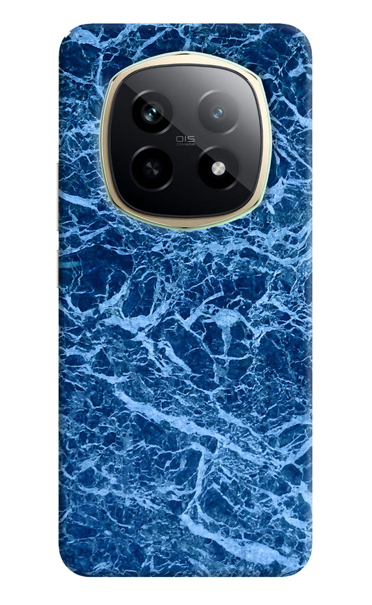 Blue Marble Realme P2 Pro 5G Hard Case Back Cover by Casekaro