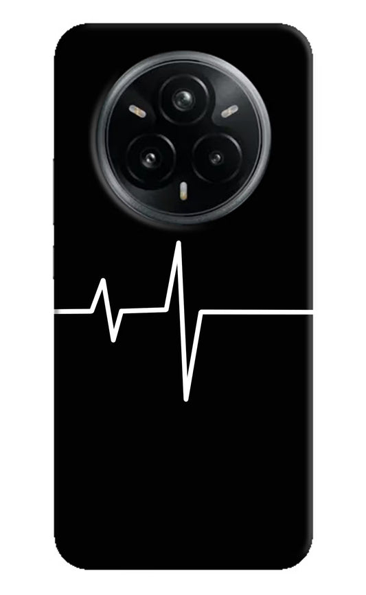 Heart Beats Realme 14 Pro Plus 5G Hard Case Back Cover by Casekaro