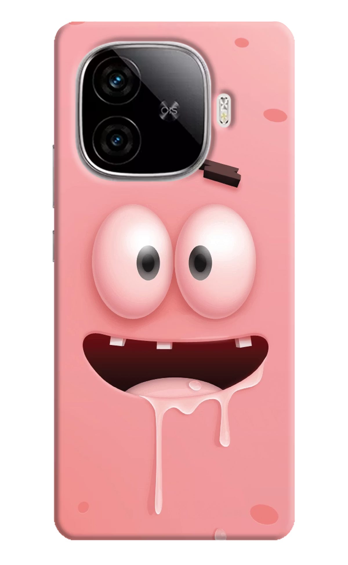 Sponge 2 iQOO Neo 10R 5G Hard Case Back Cover by Casekaro