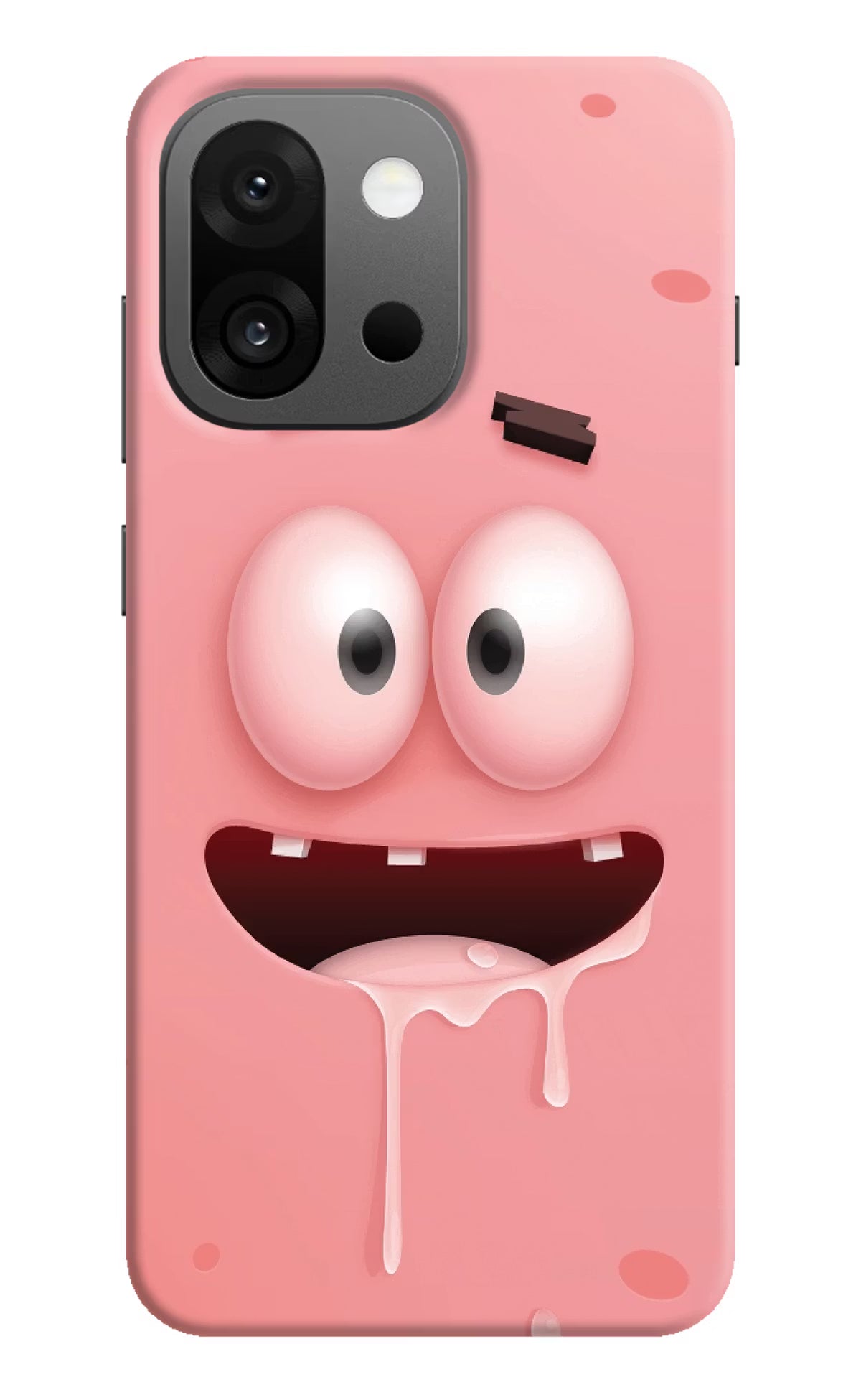 Sponge 2 OnePlus 13s Hard Case Back Cover by Casekaro