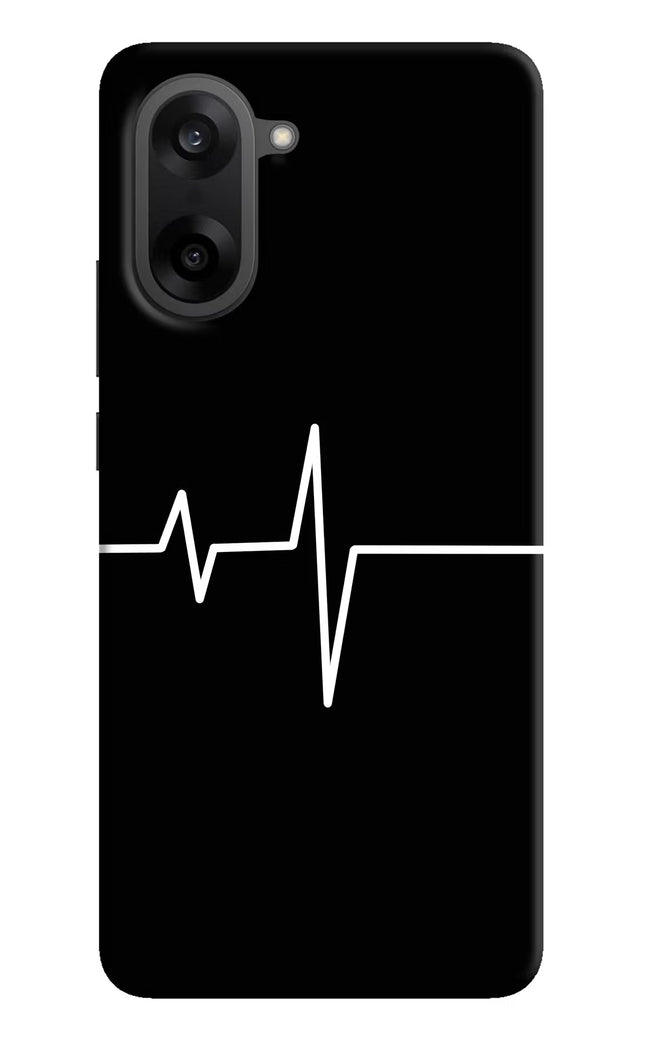 Heart Beats OnePlus Nord CE5 Hard Case Back Cover by Casekaro