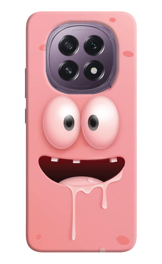 Sponge 2 Oppo F29 5G Hard Case Back Cover by Casekaro