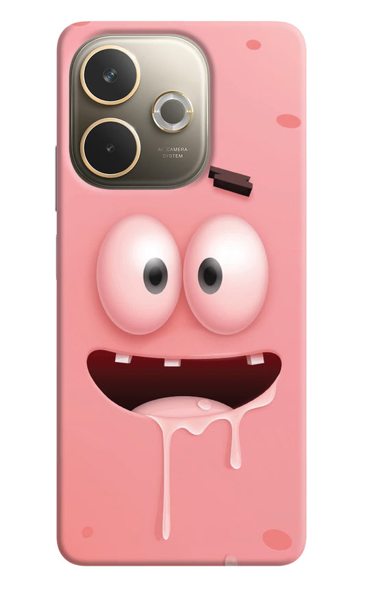 Sponge 2 Oppo A5 Pro 5G Hard Case Back Cover by Casekaro