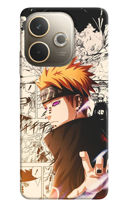 Pain Anime Oppo A5 Pro 5G Hard Case Back Cover by Casekaro