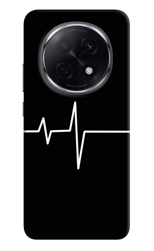 Heart Beats Oppo F29 Pro 5G Hard Case Back Cover by Casekaro