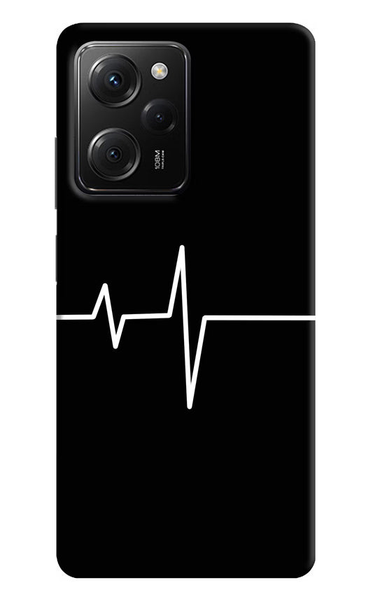 Heart Beats Poco X5 Pro 5G Hard Case Back Cover by Casekaro