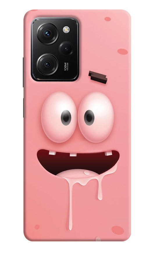 Sponge 2 Poco X5 Pro 5G Hard Case Back Cover by Casekaro