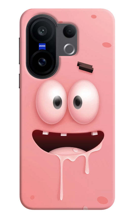 Sponge 2 Vivo X200 FE Hard Case Back Cover by Casekaro