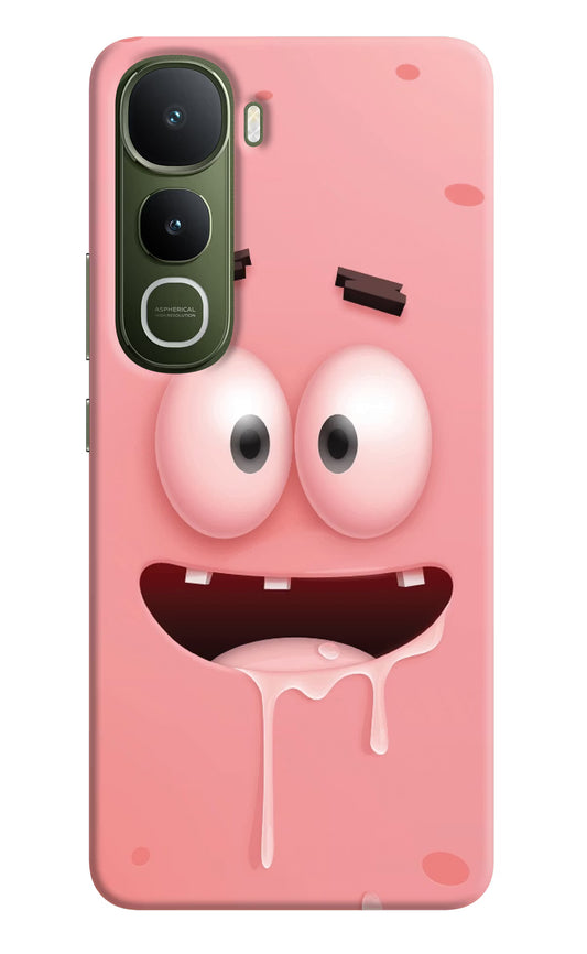 Sponge 2 Vivo Y400 5G Hard Case Back Cover by Casekaro
