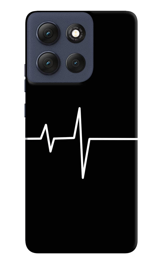Heart Beats Moto G86 Power Hard Case Back Cover by Casekaro