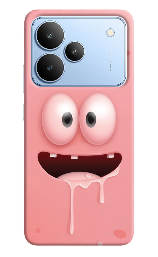 Sponge 2 Realme P4 Hard Case Back Cover by Casekaro