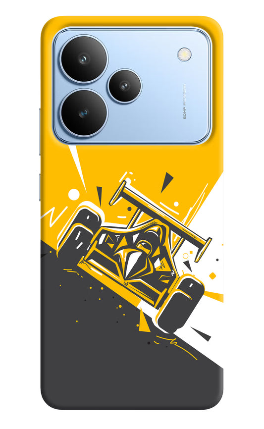 Track King Realme P4 Hard Case Back Cover by Casekaro