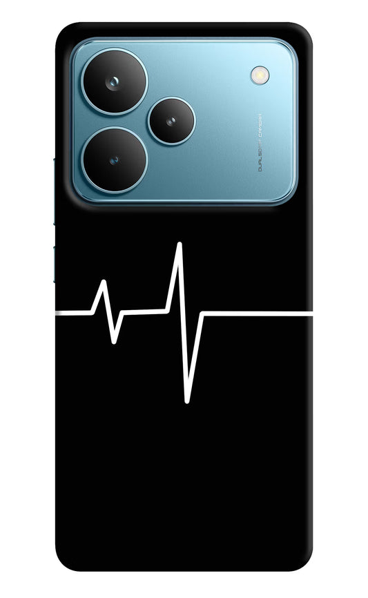 Heart Beats Realme P4 Pro Hard Case Back Cover by Casekaro