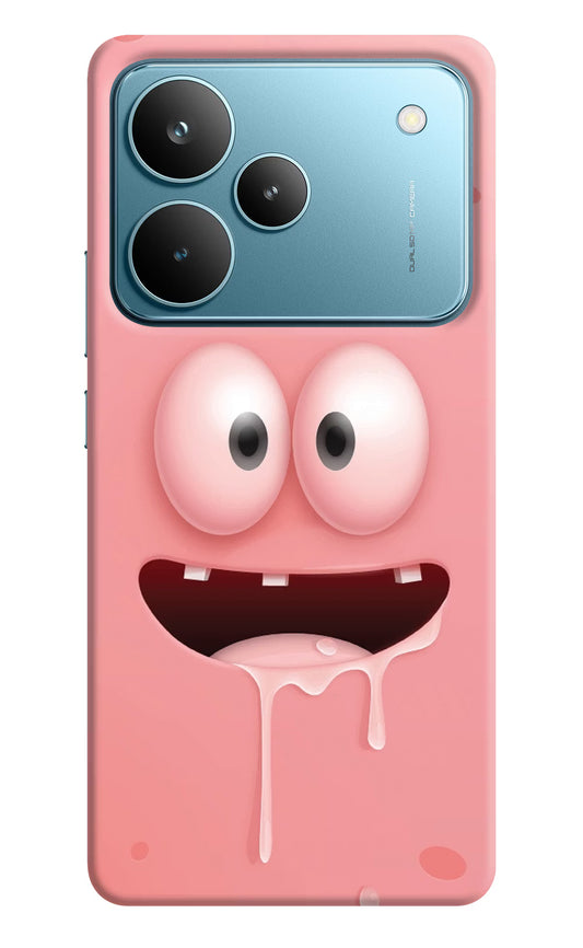 Sponge 2 Realme P4 Pro Hard Case Back Cover by Casekaro