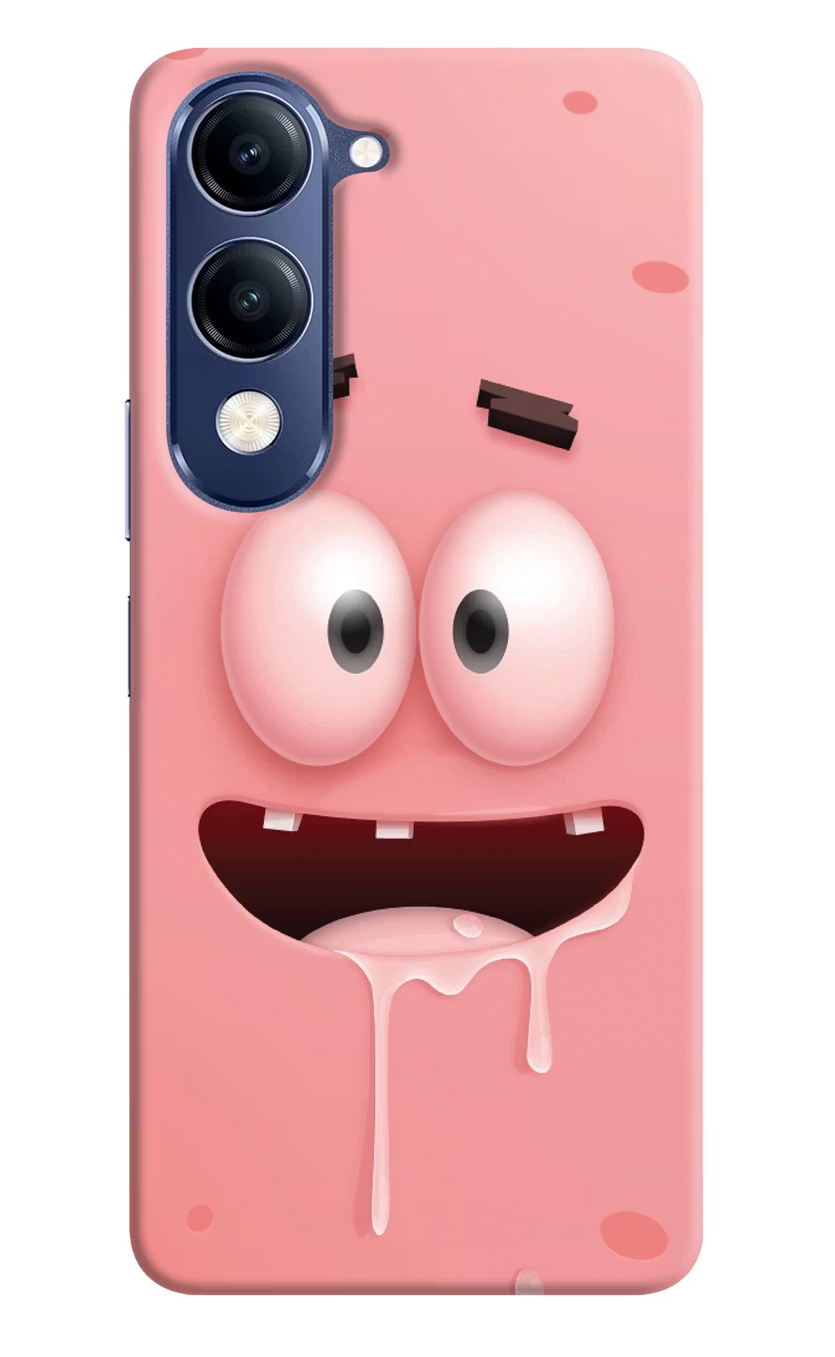 Sponge 2 Vivo V40 Lite Hard Case Back Cover by Casekaro