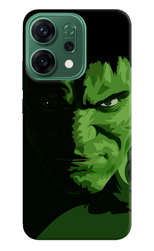 HULK Oppo Reno14 5G Hard Case Back Cover by Casekaro