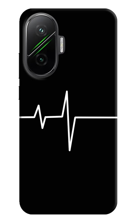 Heart Beats Poco F7 5G Hard Case Back Cover by Casekaro