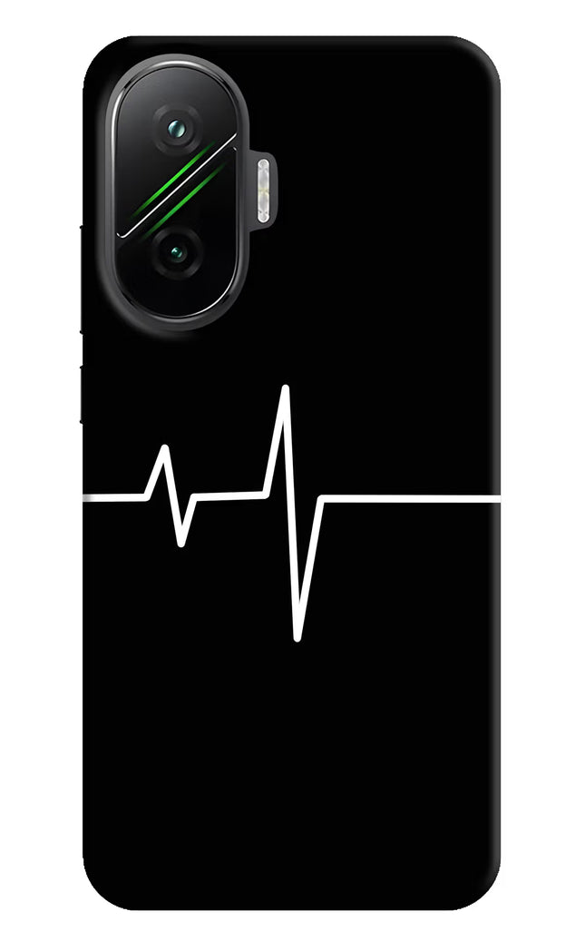 Heart Beats Poco F7 5G Hard Case Back Cover by Casekaro