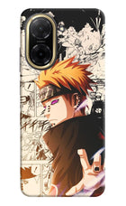 Pain Anime Redmi A5 Back Cover