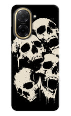 Dead Stack Redmi A5 Hard Case Back Cover by Casekaro