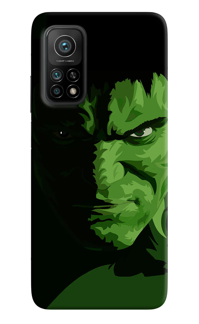 HULK Mi 10T Pro Back Cover