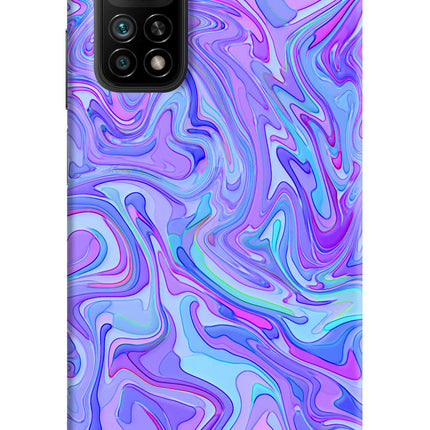 Glitter Mi 10T Pro Back Cover