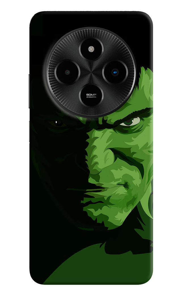 HULK Poco M7 5G Hard Case Back Cover by Casekaro