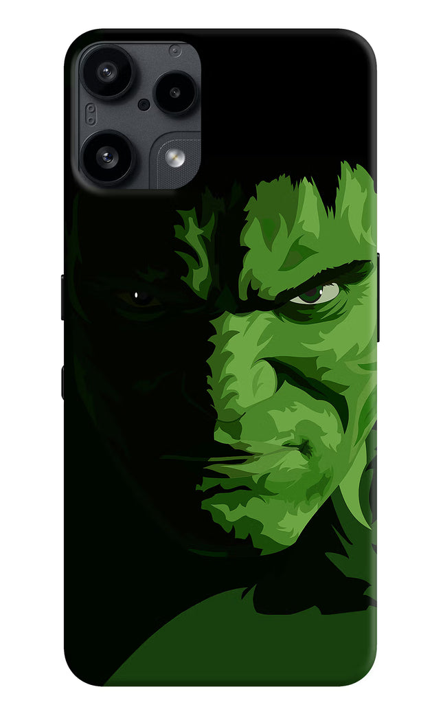 HULK Nothing Phone 3A Lite Back Cover