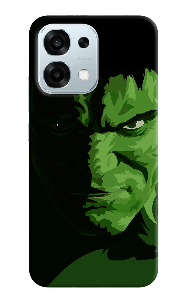 HULK Oppo F31 5G Hard Case Back Cover by Casekaro