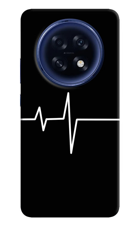 Heart Beats Oppo F31 Pro Plus 5G Hard Case Back Cover by Casekaro