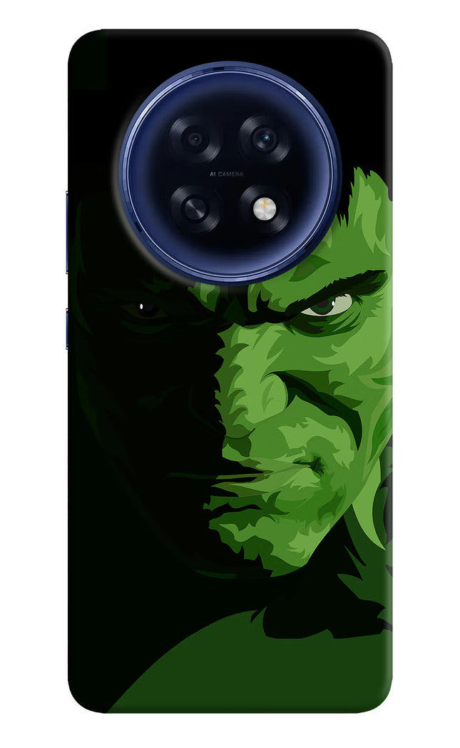 HULK Oppo F31 Pro Plus 5G Hard Case Back Cover by Casekaro