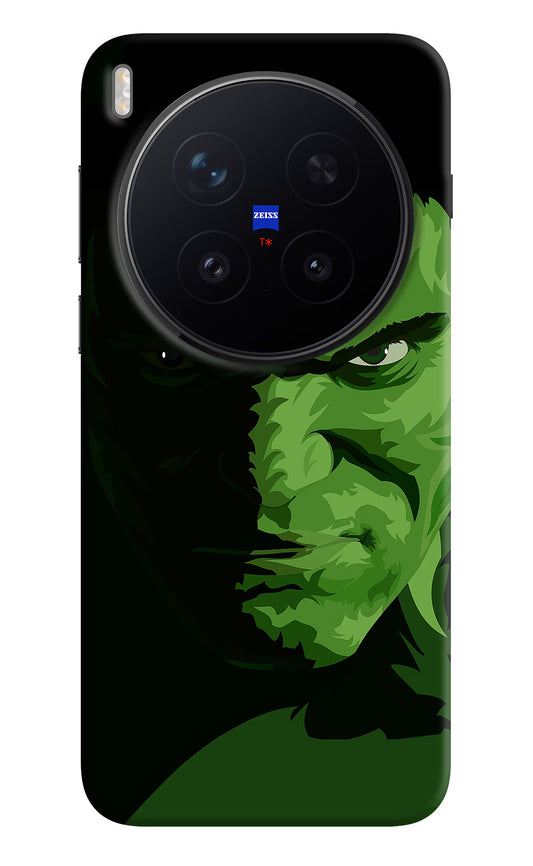 HULK Vivo X300 Pro Hard Case Back Cover by Casekaro