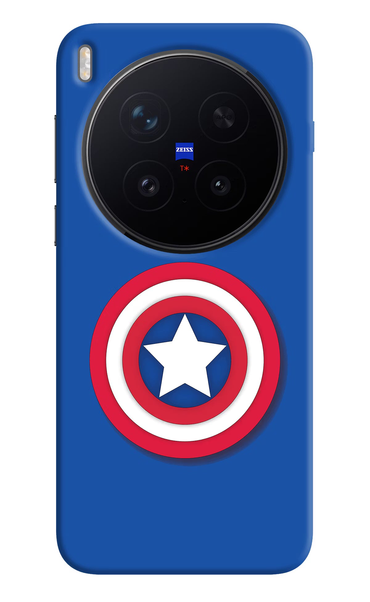 Shield Vivo X300 Pro Hard Case Back Cover by Casekaro