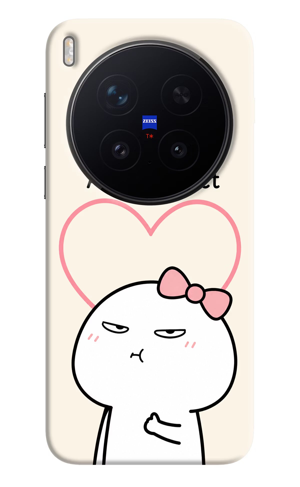 Always Right Vivo X300 Pro Hard Case Back Cover by Casekaro
