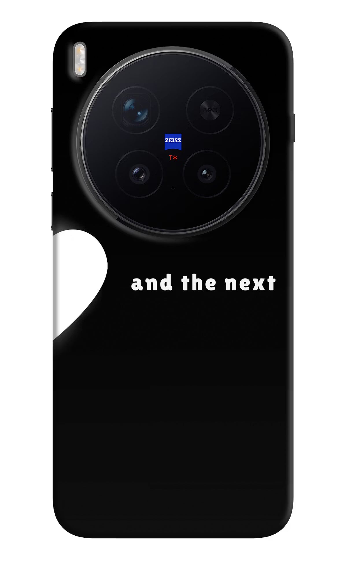 Next World Vivo X300 Pro Hard Case Back Cover by Casekaro