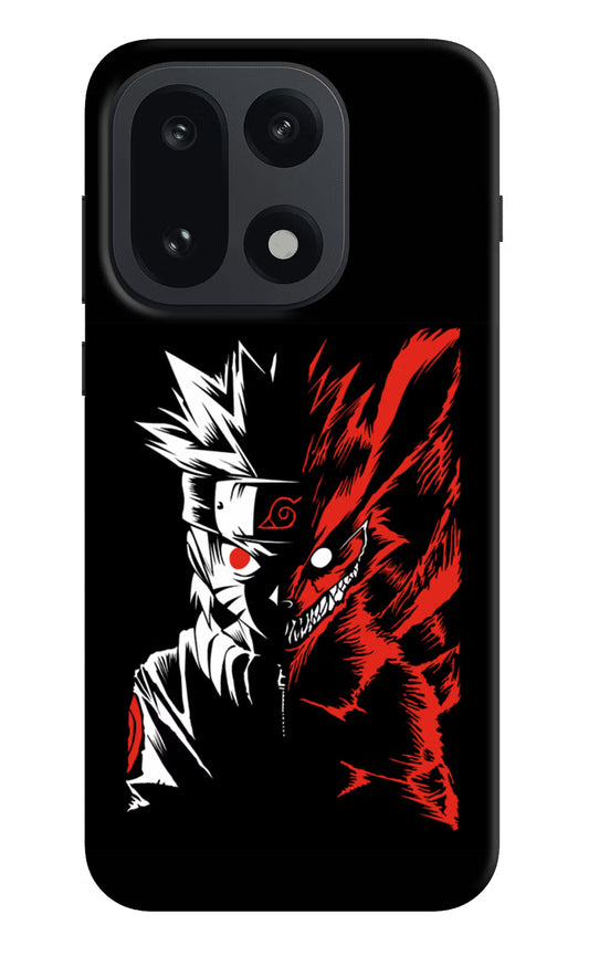 Naruto Two Face OnePlus 15 Hard Case Back Cover by Casekaro