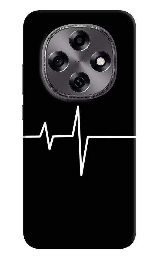 Heart Beats Oppo F31 Pro 5G Hard Case Back Cover by Casekaro
