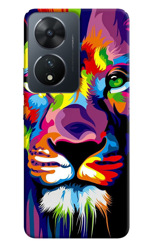 Lion Vivo T2 5G Hard Case Back Cover by Casekaro