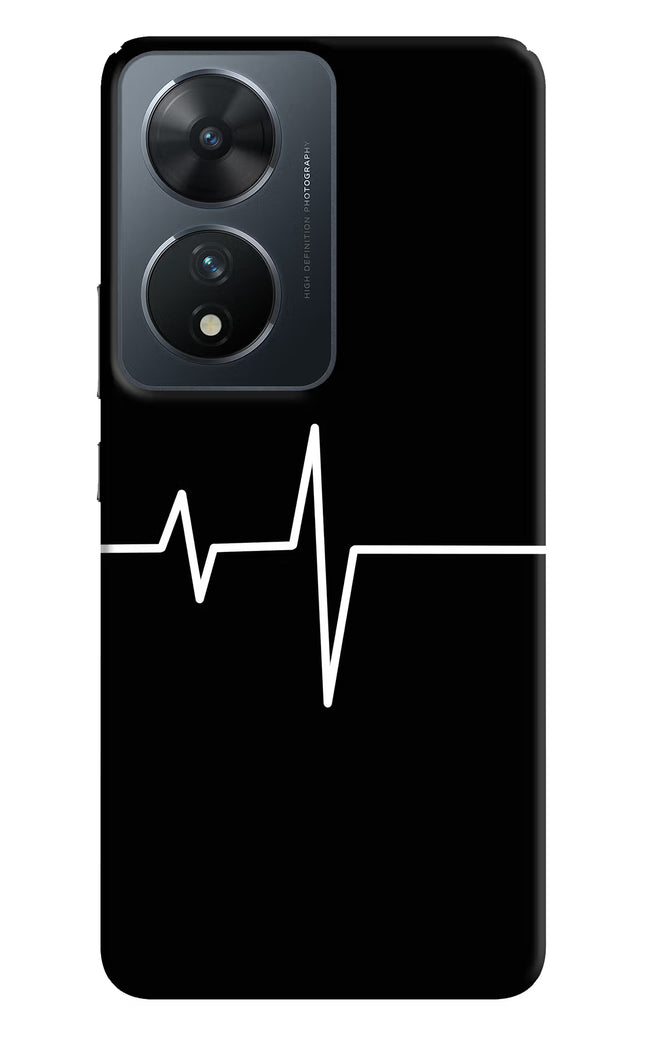 Heart Beats Vivo T2 5G Hard Case Back Cover by Casekaro