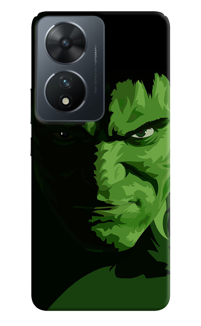 HULK Vivo T2 5G Hard Case Back Cover by Casekaro
