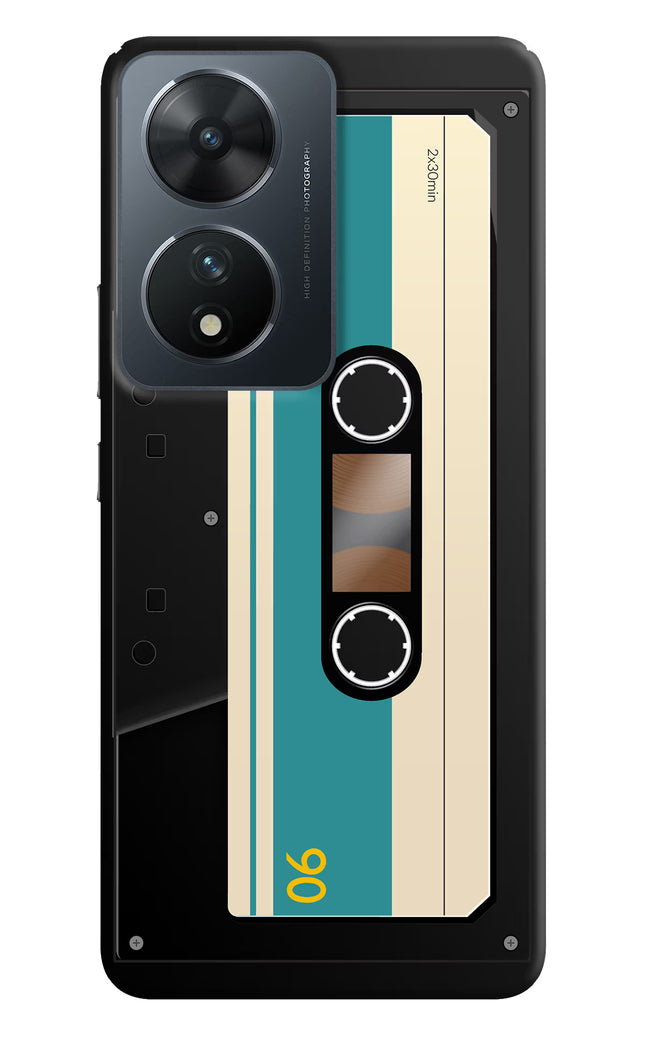 Cassette Vivo T2 5G Hard Case Back Cover by Casekaro