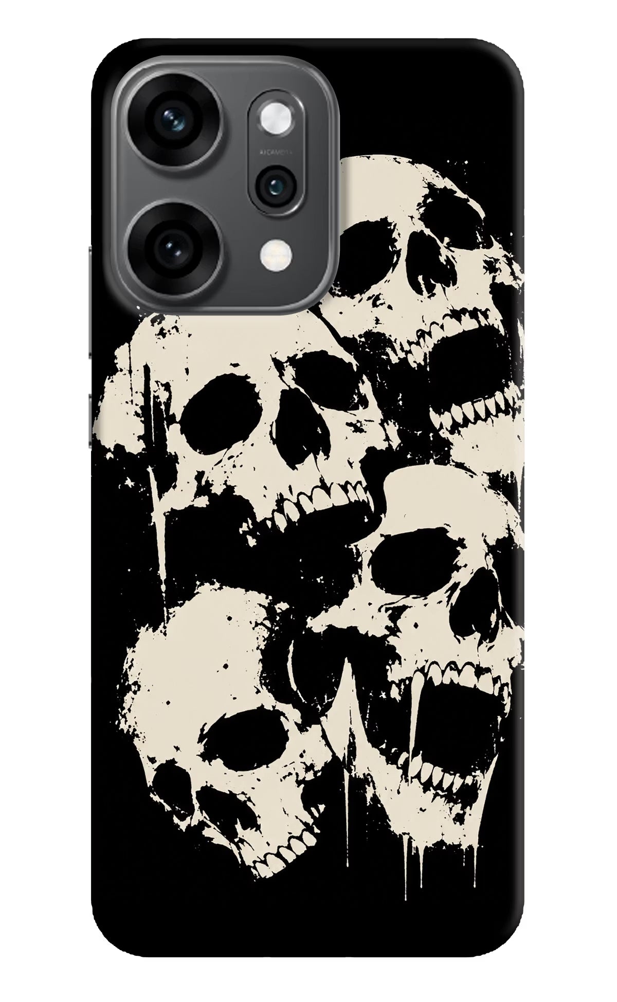 Dead Stack Oppo Reno14 Pro 5G Hard Case Back Cover by Casekaro