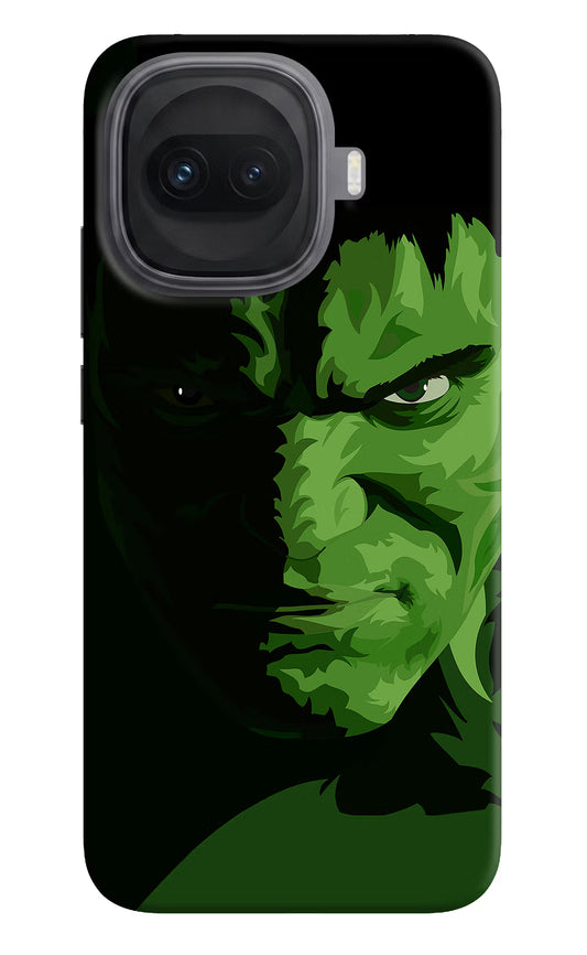 HULK iQOO 15R 5G Hard Case Back Cover by Casekaro